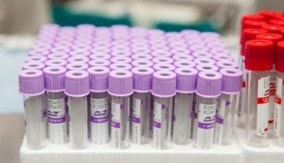 Lab Supplies